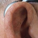 시그니아독일보청기 강동센타 이미지