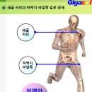 난소와 견갑골 그리고 쇄골라인의 애증의 관계 이미지
