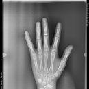 장수일치과의원 이미지