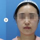 케이톡스의원인천 네이버블로그