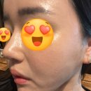 맑은하루신경과의원 | 선릉역피부과 더마톡신 주사 잘하는곳 맑은선의원