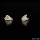 강남미라인치과의원 네이버블로그
