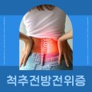 전농튼튼365마취통증의학과의원 | 전농동마취통증의학과, '척추전방전위증', 어떤 질환인가요? 원인과 증후, 예방법까지!