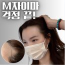 지나라인 | [울산헤어라인문신] M자 이마 채우는 달동 마노뷰티 퀵앤핏헤어라인 후기