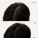 탈모왕 광주점 이미지