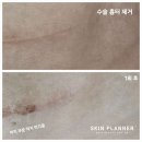 피부관리 스킨플래너 인천청라점 인천 서구 청라동 가격위치주소이벤트할인 총정리