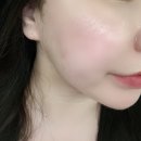 주식회사 케어포유 | [초유 엑소좀앰플] 4세대 스피큘 초유 엑소좀 | 바르고 나서 피부가 진짜 달라졌어요✨