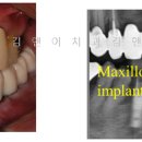 샤인치과기공소 이미지
