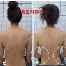 레푸스칠곡점앤 네일비치 | 대구 칠곡 피부관리 등관리 받으러 방문한 ㅣ 가인뷰티 (레푸스 샵인샵)