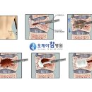 오케이참병원 이미지