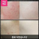 하나로Ⅱ주유소 | 더마콜 악마파운데이션솔직후기입니당~^^