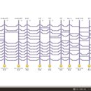 예손헤어라인 이미지
