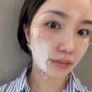 [서울] 서울 신논현역 피부과 쥬베룩 볼륨 후기