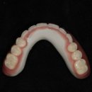 위드치과기공소 이미지