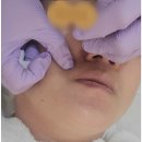 능곡제일한의원 | 장현지구 시흥피부관리 < 더바온 에스테틱> 수분관리와 블랙헤드 제거 / 능곡역피부관리