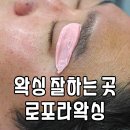 로포라 슈가 왁싱 | 대구 슈가링 왁싱샵 아프지않아 좋았던 로포라왁싱 후기