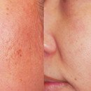 미소라인 이미지