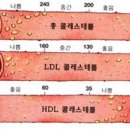 총콜레스테롤 농도 210-249 가장 좋다. 이미지