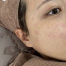 씨유옥정세영리첼점 | 양주 옥정 신부피부관리 잘하는 피부관리샵 비비드엘 기미 제거 딱쟁이 후기