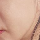 리멤버피부과의원(강서마곡점) 이미지