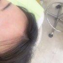 멜팅왁싱 - 포항시 북구 | 포항 우현동 페이스왁싱 멜팅왁싱 후기