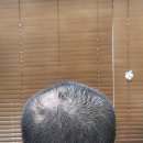 엔젤아이의원 이미지