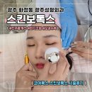덜아픈세상 - 중구 중구로33번길 14 | 광주성형외과 [스킨보톡스]코어톡스 붓기, 멍, 통증 후기