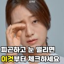 마그내다리승강장 | 눈떨림 그냥 넘기지 마세요, 마그네슘 부족 증상과 영양제 추천(마그도스)