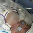 순천우리병원 | [NICU 입원 후기] 순천현대병원 니큐 입원, 병원비, 입원비, 태아보험 청구 후기