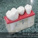 성수치과의원 네이버블로그