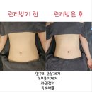 20년 전통, 특허받은 근막테라피로 유명한 평택 약손테라피 방문 후기