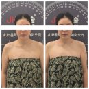비채2 | 익산 어양동 피부관리 [비채뷰티] JH얼굴윤곽관리 다녀온 리얼후기~