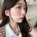 창원피부과 올타이트리프팅 400샷 통증, 전후 솔직후기