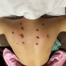 주식회사 메인헬스케어 | 강남구청 등드름관리 살롱드비숑 강남점ND헬스케어 신부바디케어