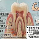 연세고마운치과 - 서대문구 통일로 456 | [아산 연세원치과]신경치료 후 내 치아 같지 않은 '붕 뜬 느낌', 언제쯤 괜찮아질까요?