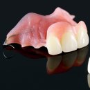 굿디자인 치과기공소 네이버블로그
