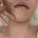 미.미애피부샵 | [Beauty 용인피부샵] 뷰티풀미 플리즈마관리 1000%만족 후기🌝🧡