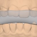 바라던 치과기공소 이미지