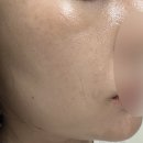 청담초등학교 | 청담동의원/청담피부과/쥬베룩볼륨/앞볼차오름 후기