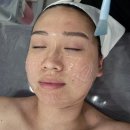 CU 양산신도시점 | 양산에스테틱 양산피부관리 뷰티센트리 민감성 피부 홍조 관리 체험 후기