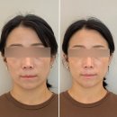 농업기술원 맞은편 | 진주 비대칭 관리는 뷰티에이블 만족스러운 두골비 관리