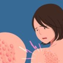 (주)아이비유 네이버블로그