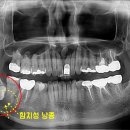 세상모든사랑니치과의원 이미지