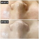 331 | 대전 대덕구 플레이스킨 송촌점 피부관리 방문 후기
