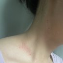 미드림성형외과의원 네이버블로그