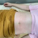 이끌림 | 구로비만웨딩관리 이끌림 밸런스케어에서 받은 복부관리 후기