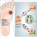 산성보건지소 화장실 | 내 발은 썩어가고 있었다. (200만 원 날리고 7년만에 찾은 무좀 생존 공식)