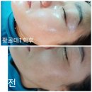 골드 휴 이미지