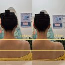 예뻐졌다 동의대역점 | [부산/동의대] 부산신부관리 승모근관리 추천 예뻐졌다 동의대역점