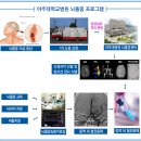 뇌졸중 환자, 응급실에 될 수 있는 한 빨리 오세요 이미지